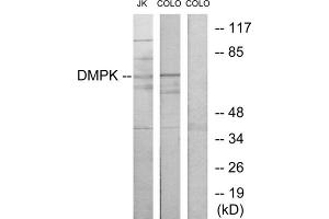 Western blot analysis of extracts from Jurkat cells and COLO205 cells, using DMPK antibody. (DMPK 抗体  (N-Term))
