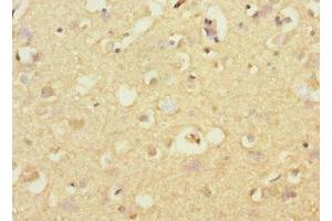 Immunohistochemistry of paraffin-embedded human brain tissue using ABIN7170731 at dilution of 1:100 (STRADA 抗体  (AA 25-210))