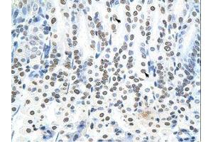 Image no. 1 for anti-RING Finger Protein 6 (RNF6) (N-Term) antibody (ABIN202860) (RNF6 抗体  (N-Term))