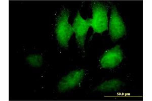 Immunofluorescence of monoclonal antibody to TOMM34 on HeLa cell. (TOMM34 抗体  (AA 1-309))