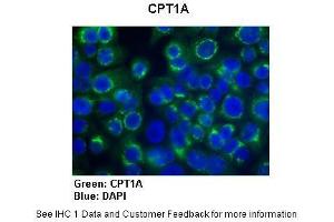 Immunohistochemistry (IHC) image for anti-Carnitine Palmitoyltransferase 1A (Liver) (CPT1A) (Middle Region) antibody (ABIN2782010)