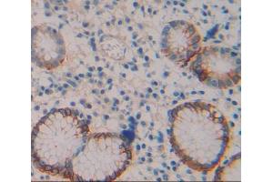 Immunohistochemistry (IHC) image for anti-Transient Receptor Potential Cation Channel, Subfamily V, Member 6 (TRPV6) (AA 578-725) antibody (ABIN5014440)