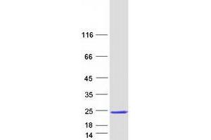 Western Blotting (WB) image for Ribonuclease P/MRP 25 Subunit-Like (RPP25L) (Transcript Variant 1) protein (Myc-DYKDDDDK Tag) (ABIN2712979)
