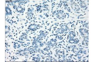 Immunohistochemical staining of paraffin-embedded breast tissue using anti-LTA4H mouse monoclonal antibody. (LTA4H 抗体)