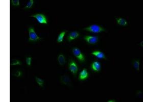 Immunofluorescence staining of A549 cells with ABIN7146512 at 1:533, counter-stained with DAPI. (Calpain S1 抗体  (AA 1-268))