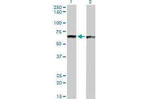 Western Blot analysis of PTBP1 expression in transfected 293T cell line by PTBP1 monoclonal antibody (M01), clone 3H8. (PTBP1 抗体  (AA 45-144))