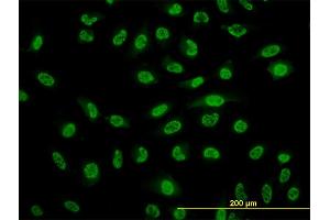 Immunofluorescence of monoclonal antibody to NFKB1 on HeLa cell.