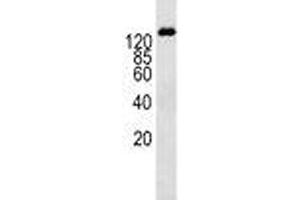 P-Glycoprotein antibody western blot analysis in K562 lysate (P-Glycoprotein 抗体  (AA 647-677))