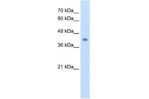 WB Suggested Antibody Titration:  2. (GCDH 抗体  (C-Term))