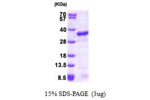 SDS-PAGE (SDS) image for Ubiquitin-Conjugating Enzyme E2S (UBE2S) (AA 1-222) protein (His tag) (ABIN666888) (UBE2S Protein (AA 1-222) (His tag))
