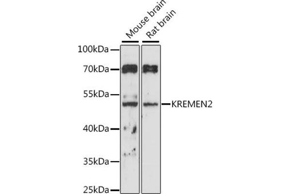 KREMEN2 抗体  (AA 200-360)