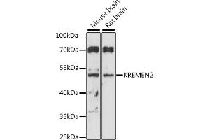 Western blot analysis of extracts of various cell lines, using KREMEN2 antibody (ABIN7268149) at 1:1000 dilution. (KREMEN2 抗体  (AA 200-360))