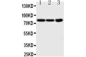 Anti-TrkA antibody,  Western blotting Lane 1: COLO320 Cell Lysate Lane 2:  Cell Lysate Lane 3: U87 Cell Lysate