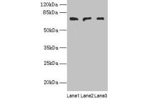 Western blot All lanes: PLCZ1 antibody at 3 μg/mL Lane 1: Mouse liver tissue Lane 2: Mouse kidney tissue Lane 3: Human placenta tissue Secondary Goat polyclonal to rabbit IgG at 1/10000 dilution Predicted band size: 71, 48, 58 kDa Observed band size: 71 kDa (PLCz1 抗体  (AA 1-415))