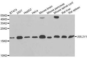 Western blot analysis of extracts of various cell lines, using UBE2V1 antibody. (UBE2V1 抗体  (AA 1-147))