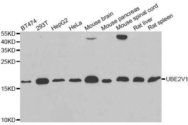 UBE2V1 Antikörper  (AA 1-147)