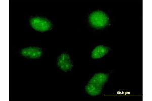 Immunofluorescence (IF) image for anti-Zinc Finger, C3HC-Type Containing 13 (ZCCHC13) (AA 1-166) antibody (ABIN949968)