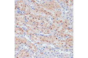 Immunohistochemistry of paraffin-embedded mouse kidney using CLDN17 antibody (ABIN7266407) at dilution of 1:100 (40x lens). (Claudin 17 抗体  (C-Term))