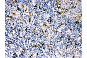 Anti- Cystatin A Picoband antibody, IHC(P) IHC(P): Human Tonsil Tissue (CSTA 抗体  (AA 8-98))