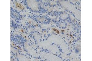 Immunohistochemistry (IHC) image for anti-Nuclear Receptor Subfamily 3, Group C, Member 1 (Glucocorticoid Receptor) (NR3C1) (AA 528-777) antibody (ABIN7441763)