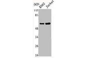 Western Blot analysis of Jurkat K562 cells using MMP-1 Polyclonal Antibody