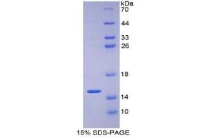 SDS-PAGE of Protein Standard from the Kit (Highly purified E. (GLUT1 ELISA 试剂盒)