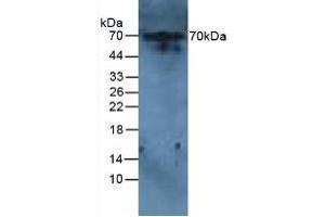 Western blot analysis of Rat Liver Tissue. (IL-6 Receptor 抗体  (AA 385-462))