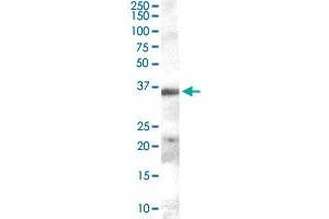 HAVCR2 polyclonal antibody  (0.