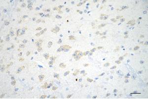 Immunohistochemistry was performed on paraffin-embedded mouse brain using ADAM17 antibody (ABIN7797502), 1:200). (Recombinant ADAM17 抗体)