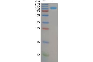SDS-PAGE (SDS) image for Dipeptidyl-Peptidase 4 (DPP4) (AA 29-766) protein (His tag) (ABIN7092747)