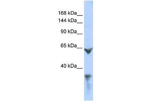 WB Suggested Anti-LRP1 Antibody Titration: 0. (LRP1 抗体  (Middle Region))