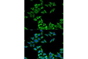 Immunofluorescence analysis of MCF-7 cells using CHMP2B antibody (ABIN6131571, ABIN6138545, ABIN6138547 and ABIN6217398). (CHMP2B 抗体  (AA 1-213))