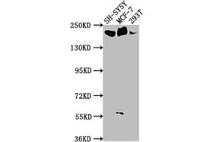 Western Blot Positive WB detected in: SH-SY5Y whole cell lysate, MCF-7 whole cell lysate, 293T whole cell lysate All lanes: LAMA4 antibody at 1:1000 Secondary Goat polyclonal to rabbit IgG at 1/50000 dilution Predicted band size: 203, 202, 13 kDa Observed band size: 203 kDa (LAMa4 抗体  (AA 1593-1823))