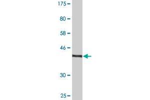 Western Blot detection against Immunogen (35. (ZNF192 抗体  (AA 1-90))