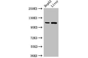 Western Blot Positive WB detected in: HepG2 whole cell lysate, Rat liver tissue All lanes: Tmprss15 antibody at 3 μg/mL Secondary Goat polyclonal to rabbit IgG at 1/50000 dilution Predicted band size: 119 kDa Observed band size: 119 kDa (TMPRSS15 抗体  (AA 830-1069))