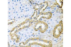 Immunohistochemistry of paraffin-embedded Rat kidney using ABL1 Polyclonal Antibody at dilution of 1:100 (40x lens). (ABL1 抗体)