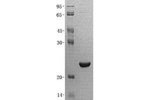 Validation with Western Blot (PMVK Protein (His tag))
