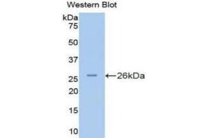 Western blot analysis of the recombinant protein. (PKN2 抗体  (AA 282-487))