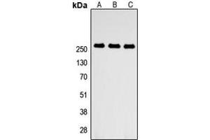 Western blot analysis of ABCA4 expression in HEK293T (A), NS-1 (B), PC12 (C) whole cell lysates. (ABCA4 抗体  (Center))