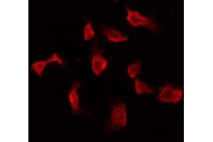 ABIN6269167 staining NIH-3T3 by IF/ICC. (PKC alpha 抗体  (C-Term))