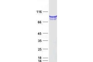 Western Blotting (WB) image for Transglutaminase 1, Keratinocyte (TGM1) protein (Myc-DYKDDDDK Tag) (ABIN2734144)