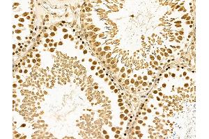 ABIN6261140 and ABIN6268860 at 1/100 staining Rat testis tissue by IHC-P. (Cyclin A1 抗体  (C-Term))