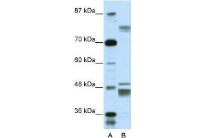 WB Suggested Anti-ZNF607 Antibody Titration:  0. (ZNF607 抗体  (Middle Region))
