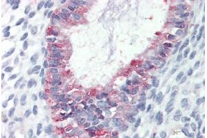 Human Uterus (formalin-fixed, paraffin-embedded) stained with GPR27 antibody ABIN410771 followed by biotinylated goat anti-rabbit IgG secondary antibody ABIN481713, alkaline phosphatase-streptavidin and chromogen. (GPR27 抗体  (Internal Region))