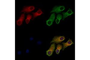 ABIN6257460 and ABIN6273388 staining HepG2 cells by IF/ICC.