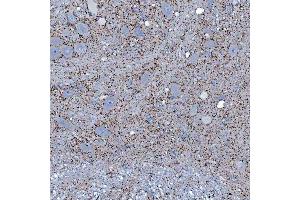 IHC analysis of SFXN5 using anti-SFXN5 antibody (ABIN7601388). (Sideroflexin 5 抗体  (AA 34-340))