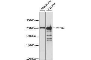 Western blot analysis of extracts of various cell lines, using MYH13 antibody (ABIN7268746) at 1:1000 dilution. (MYH13 抗体  (AA 1240-1320))