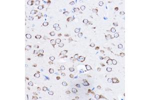 Immunohistochemistry of paraffin-embedded mouse brain using RPL8 Rabbit pAb (ABIN6128659, ABIN6147155, ABIN6147156 and ABIN6214154) at dilution of 1:50 (40x lens). (RPL8 抗体  (AA 1-257))