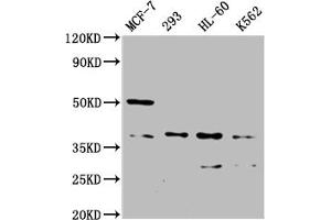 Western Blot Positive WB detected in: MCF-7 whole cell lysate, 293 whole cell lysate, HL60 whole cell lysate, K562 whole cell lysate All lanes: MRGPRX2 antibody at 1:2000 Secondary Goat polyclonal to rabbit IgG at 1/50000 dilution Predicted band size: 38 kDa Observed band size: 38 kDa (MRGPRX2 抗体  (AA 286-330))