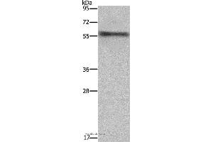 Western blot analysis of Mouse heart tissue, using FKBP8 Polyclonal Antibody at dilution of 1:1000